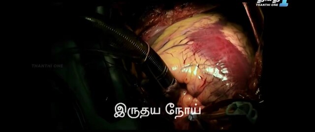 Moviesda.Mobi - Richie Kalyanam 2024 Original 720p HD (750MB).mp4
