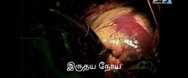 Moviesda.Mobi - Thoppur 2024 Original 720p HD.mp4